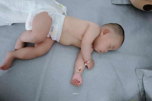 绥化宝宝上火有眼屎